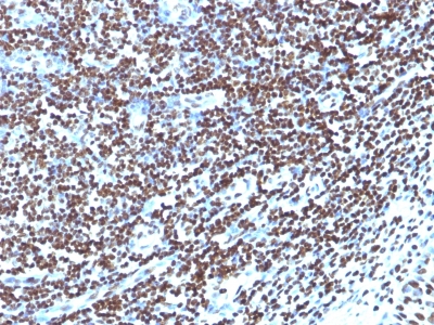 Formalin-fixed, paraffin embedded human tonsil sections stained with 100 ul anti-Histone H1 (clone HH1/957) at 1:100. HIER epitope retrieval prior to staining was performed in 10mM Citrate, pH 6.0.